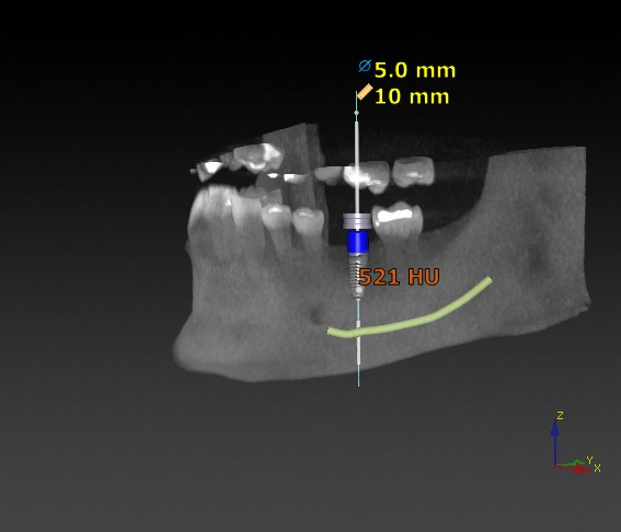 Germán López Álvarez